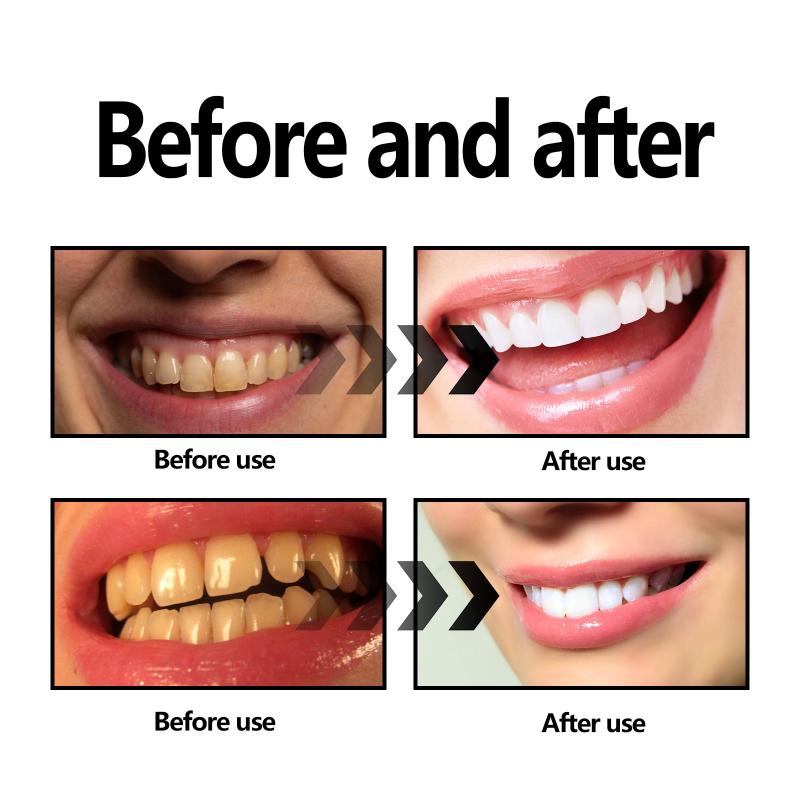 치아 미백 파우더 숯/베이킹 소다 치아 미백 파우더,  - Activated Charcoal Powder 리뷰 및 가격