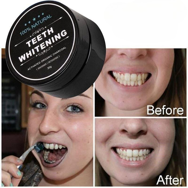 활성탄 치아 미백 파우더 1박스, 숯 치아 클리닝 파우 - Activated Charcoal Powder 리뷰 및 가격